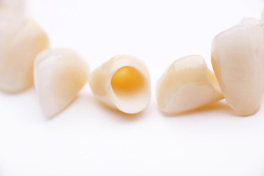 dental crowns in palatine il