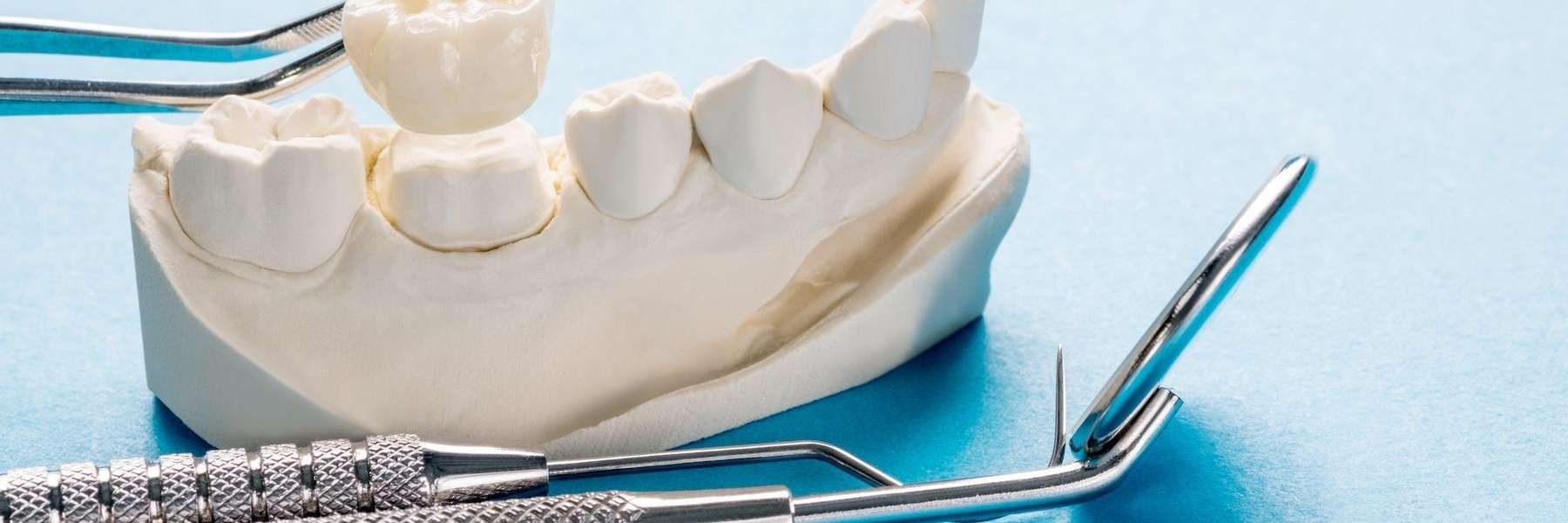 dental tools in Palatine IL