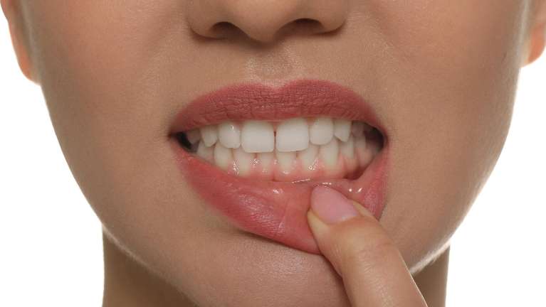 close up of woman pointing at gums