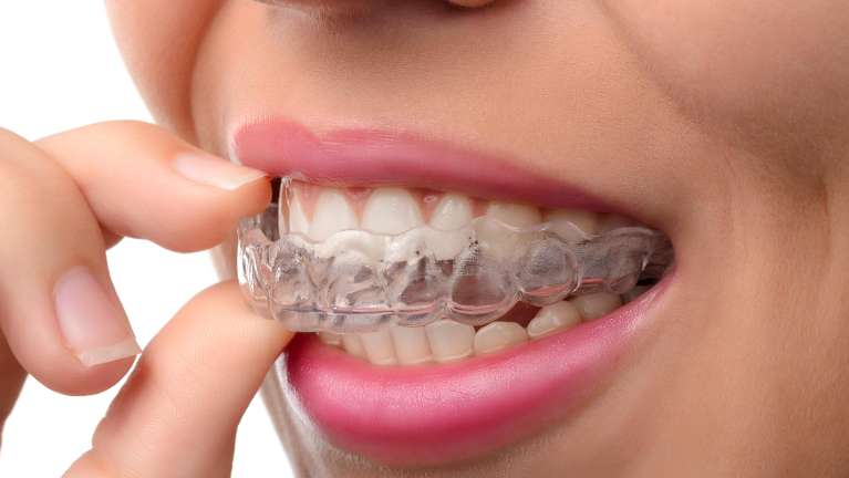 close up of woman using invisalign