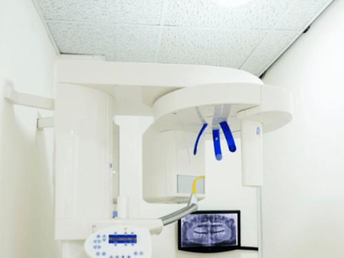 Digital X-Rays & Digital Sensors